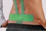 Kinesiologische Taping (K-Taping)